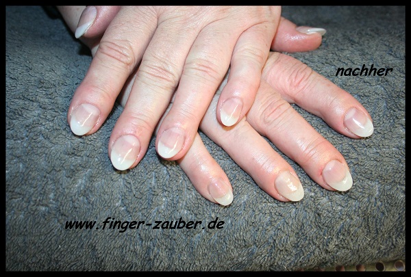 Neumodellage vorher
